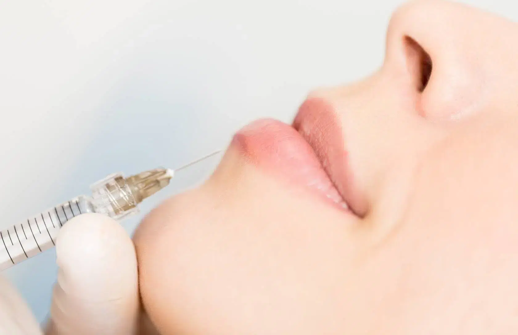 Injection acide hyaluronique lèvres russes