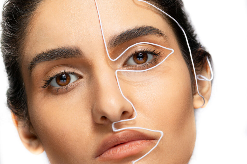 Blépharoplastie à 1 mois : quel résultat ? | Dr Petit